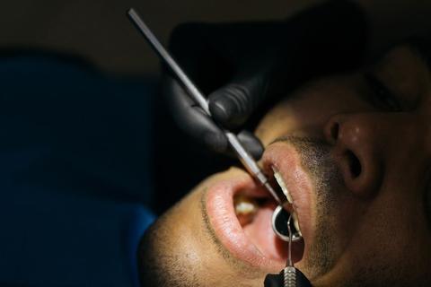 Sarro dental: peligros y cómo limpiarlo con escala dental