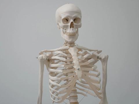 Osteoporose: Conheça os sintomas e como prevenir a perda de massa…